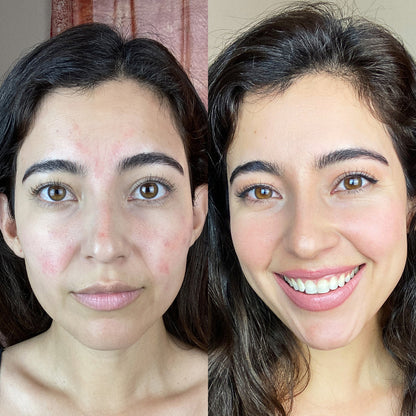 shop  𝟕-𝐢𝐧-𝟏 𝐅𝐚𝐜𝐞 & 𝐍𝐞𝐜𝐤 𝐓𝐢𝐠𝐡𝐭𝐞𝐧𝐢𝐧𝐠 𝐃𝐞𝐯𝐢𝐜𝐞| 𝐋𝐄𝐃 𝐋𝐢𝐠𝐡𝐭 𝐓𝐡𝐞𝐫𝐚𝐩𝐲 & 𝐖𝐫𝐢𝐧𝐤𝐥𝐞 𝐑𝐞𝐦𝐨𝐯𝐞𝐫