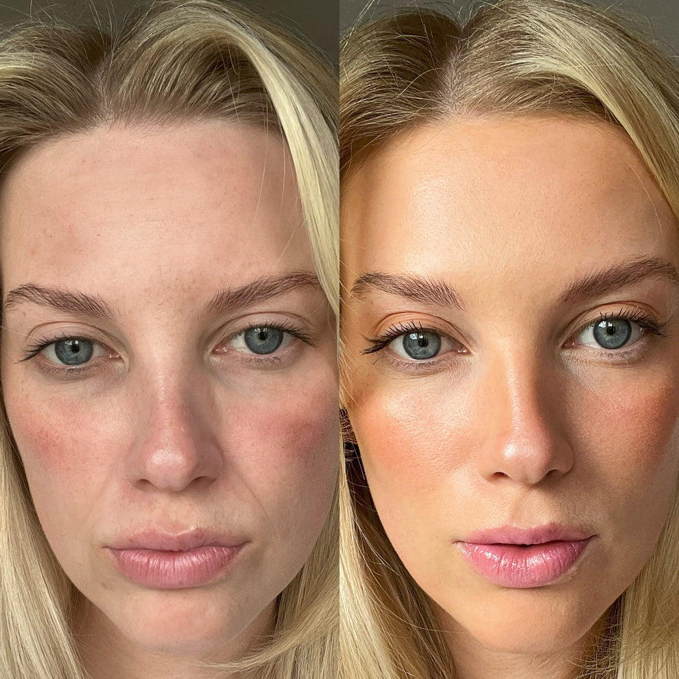 shop  𝟕-𝐢𝐧-𝟏 𝐅𝐚𝐜𝐞 & 𝐍𝐞𝐜𝐤 𝐓𝐢𝐠𝐡𝐭𝐞𝐧𝐢𝐧𝐠 𝐃𝐞𝐯𝐢𝐜𝐞| 𝐋𝐄𝐃 𝐋𝐢𝐠𝐡𝐭 𝐓𝐡𝐞𝐫𝐚𝐩𝐲 & 𝐖𝐫𝐢𝐧𝐤𝐥𝐞 𝐑𝐞𝐦𝐨𝐯𝐞𝐫